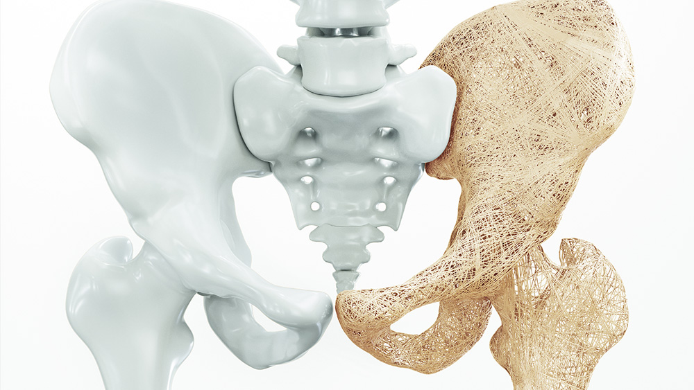 Phases of Osteoporosis and bone density